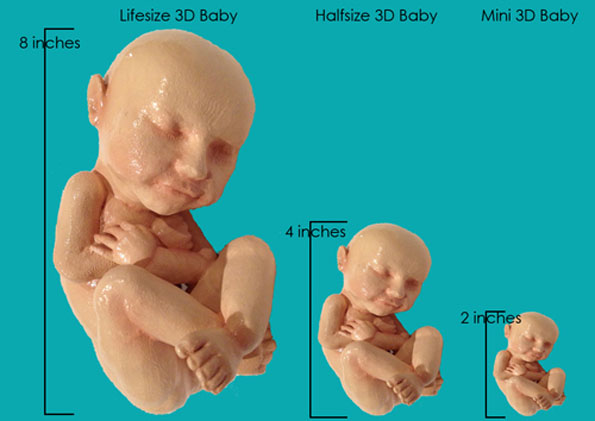 3D Printed Replica Of Your Unborn Fetus