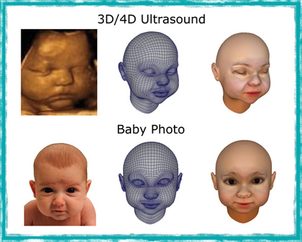3D Printed Replica Of Your Unborn Fetus