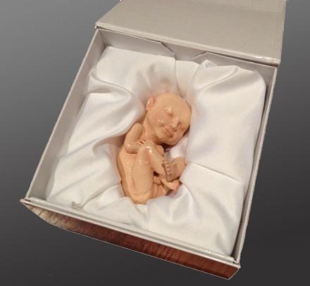 3D Printed Replica Of Your Unborn Fetus