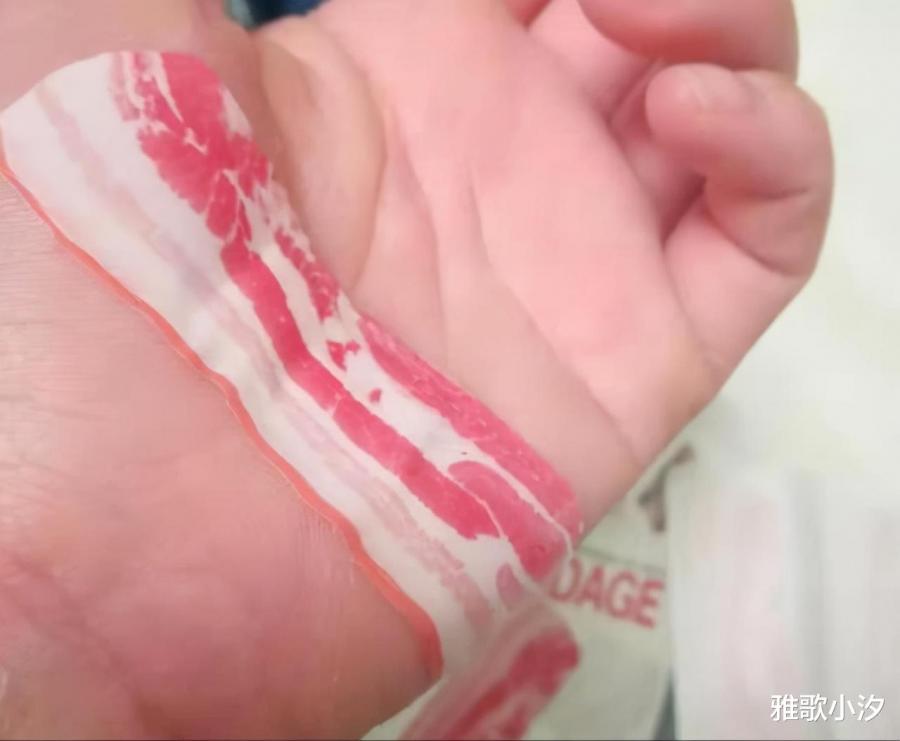 Bacon Bandages