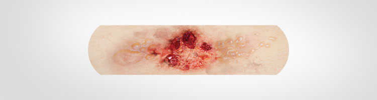 Boo-Boos Band-Aids Pictures of Severe Injuries