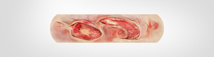 Boo-Boos Band-Aids Pictures of Severe Injuries