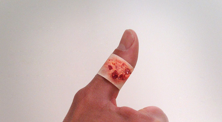 Boo-Boos Band-Aids Pictures of Severe Injuries