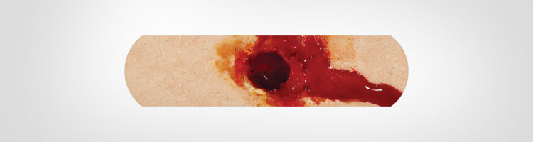 Boo-Boos Band-Aids Pictures of Severe Injuries