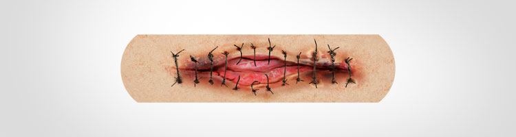Boo-Boos Band-Aids Pictures of Severe Injuries