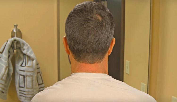 Barber's Edge Hairline Trimmer - DIY Neckline trimmer - Lets you trim your own neck