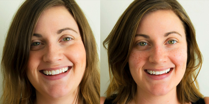 Freck Yourself - Semi-Permanent Freckle Cosmetic