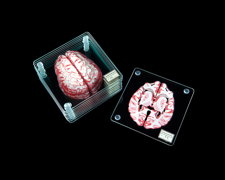 Brain Specimen Coasters