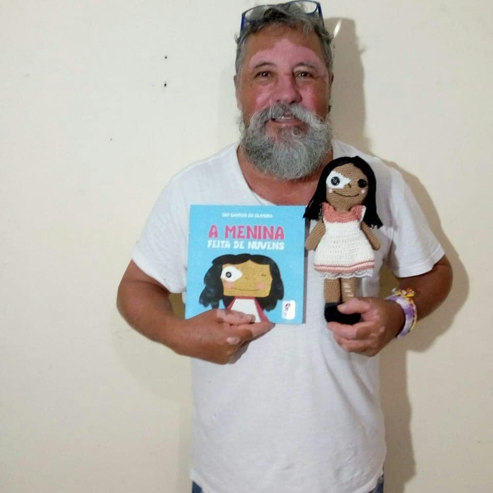 vitiligo crochet dolls - Grandfather with vitiligo skin condition creates crochet dolls