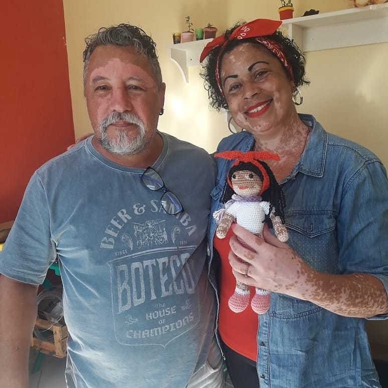 vitiligo crochet dolls - Grandfather with vitiligo skin condition creates crochet dolls