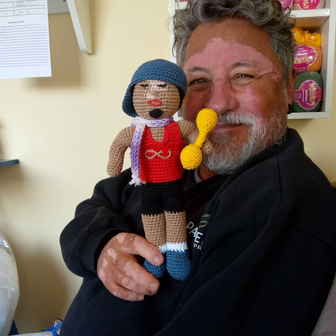 vitiligo crochet dolls - Grandfather with vitiligo skin condition creates crochet dolls