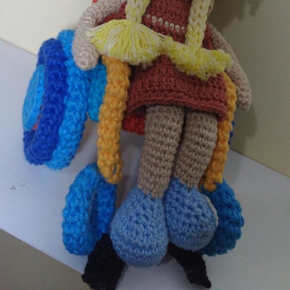 vitiligo crochet dolls - Grandfather with vitiligo skin condition creates crochet dolls