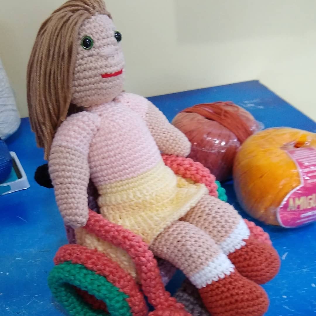 vitiligo crochet dolls - Grandfather with vitiligo skin condition creates crochet dolls