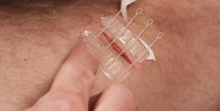 ZipStitch Home Laceration Kit Lets you heal wounds without stitches - DIY Home stitches