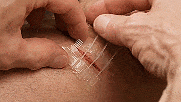 ZipStitch Home Laceration Kit Lets you heal wounds without stitches - DIY Home stitches