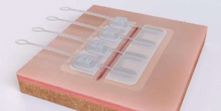 ZipStitch Home Laceration Kit Lets you heal wounds without stitches - DIY Home stitches